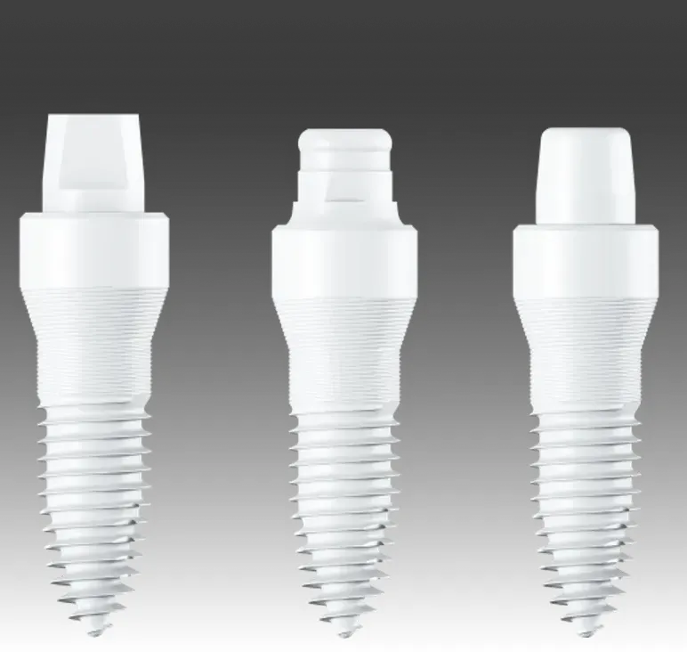Dental implant illustration